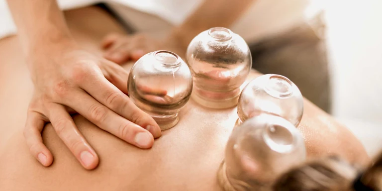 Cupping Therapy
